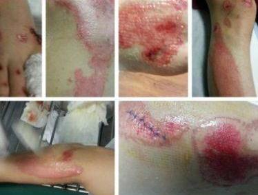 明星經(jīng)紀公司:李雨桐曝薛之謙車禍借疤賣慘