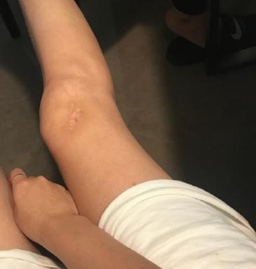 明星經(jīng)紀公司:李雨桐曝薛之謙車禍借疤賣慘